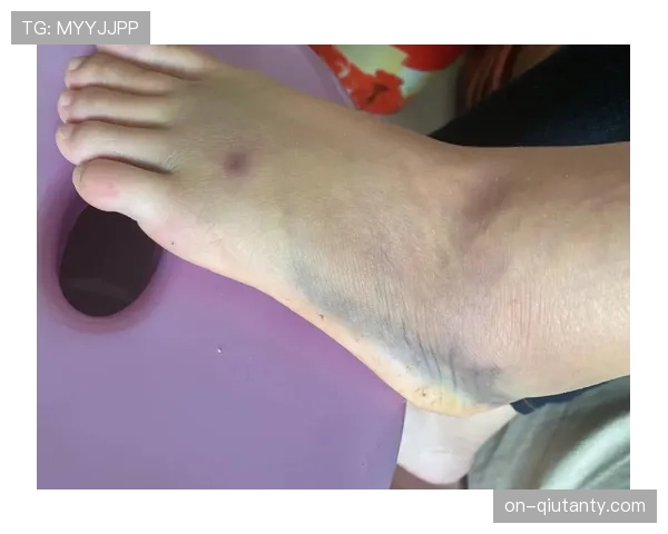 伤病通讯：盘点国际比赛日后，各国脚因疲劳导致的肌肉拉伤与突破型球员的关系